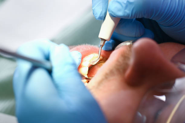 Best Walk-In Emergency Dentist in Line Acres, MO