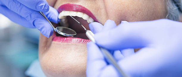 Best Emergency Root Canal Treatment in Line Acres, MO