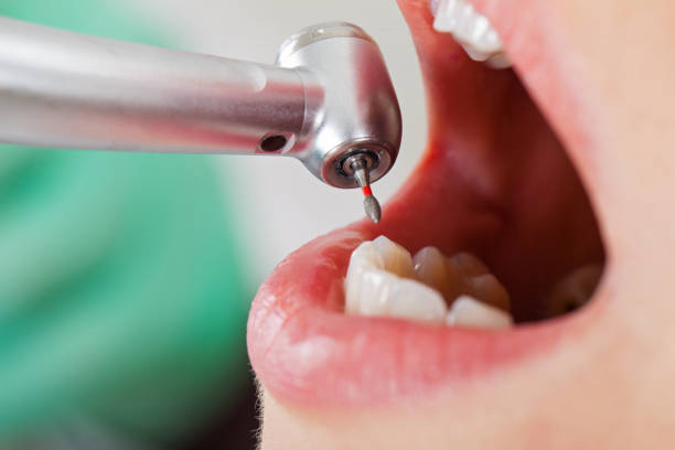 Best Emergency Treatment for Toothache in Line Acres, MO